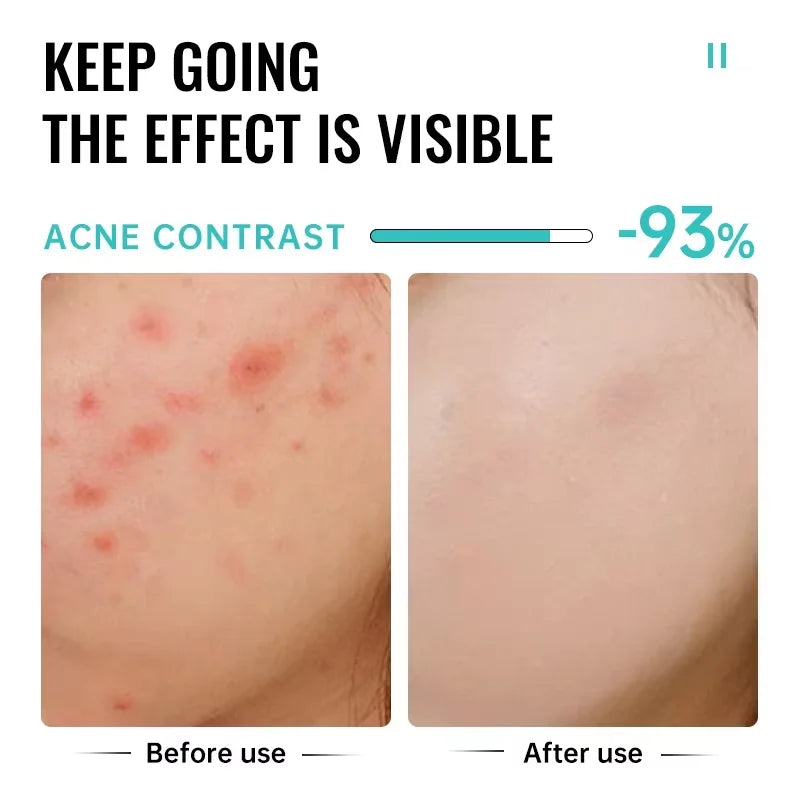 ClearDerm Cream