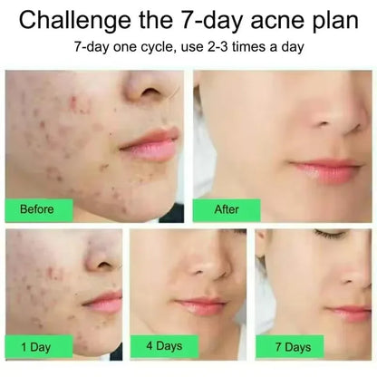 ClearDerm Cream