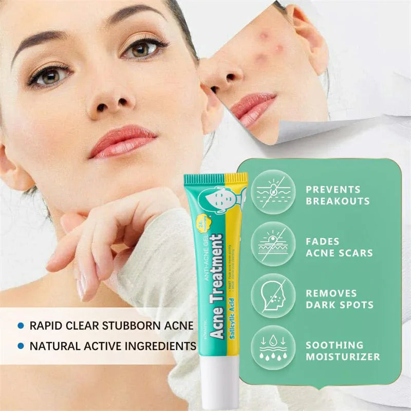 PoreLift Acne Cream