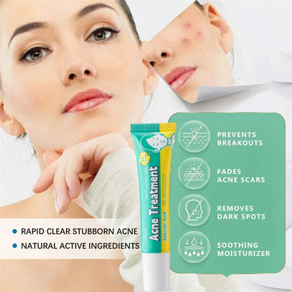 PoreLift Acne Cream