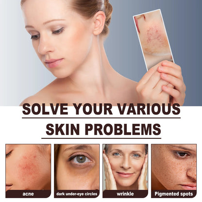 RenewGlow Peel