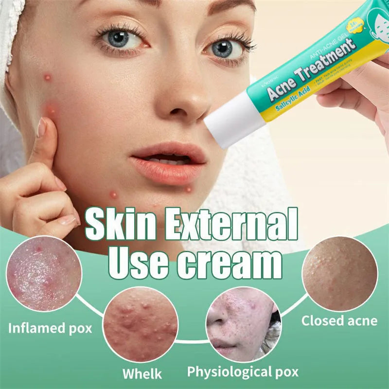 PoreLift Acne Cream