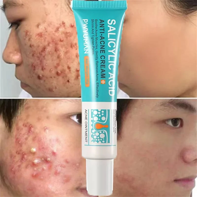 ClearDerm Cream