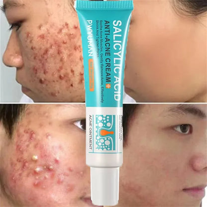 ClearDerm Cream