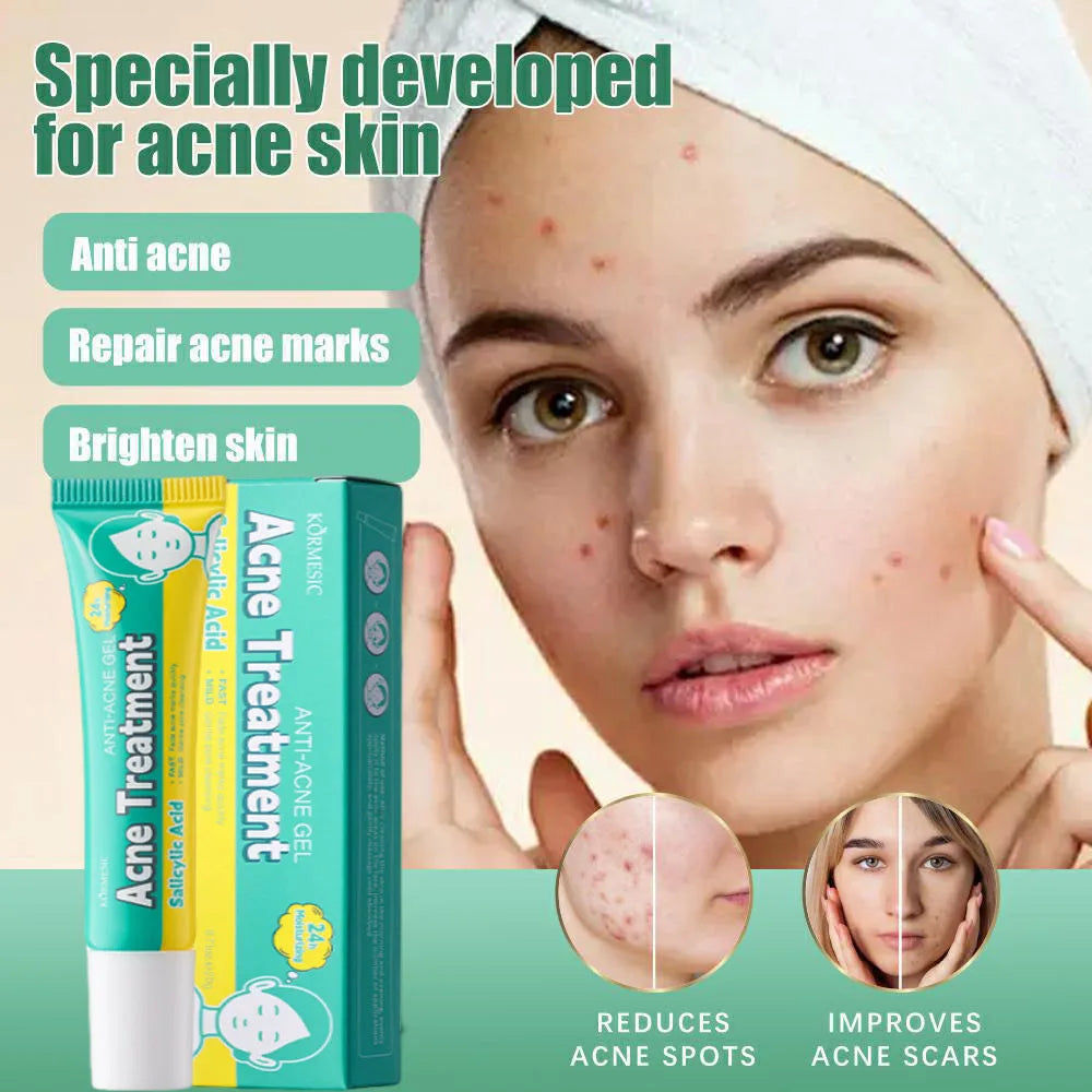 PoreLift Acne Cream