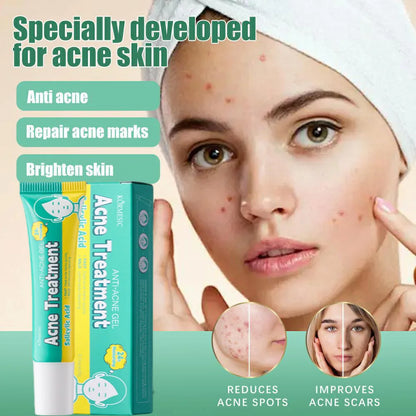 PoreLift Acne Cream
